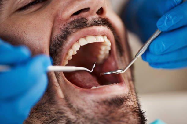 Best Emergency Dental Care  in North Edwards, CA